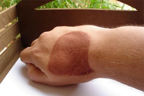 Как смыть йод с кожи: простые и эффективные методы 03