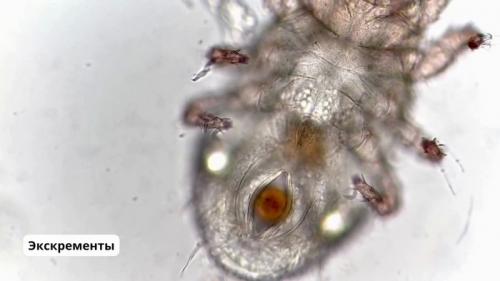 Какие условия наиболее благоприятны для появления пылевых клещей в мебели и коврах. Маленькие монстры, что живут в каждой квартире. Всё, что нужно знать о пылевых клещах