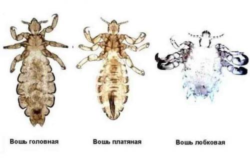 Полное руководство: как эффективно избавиться от клещей в волосах 02