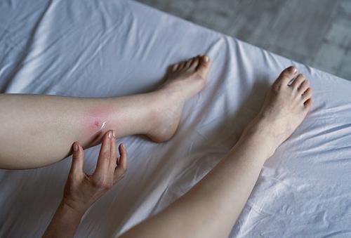 Как предотвратить повторное появление блох и клещей в доме. Чем опасно появление блох?