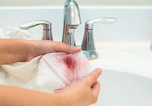 Чем оттереть краску для волос с мебели. Как отстирать краситель для волос с одежды