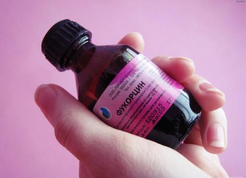 Чем отмыть Фукорцин с кожи ребенка. Препараты и средства для смывания фукорцина с кожи.