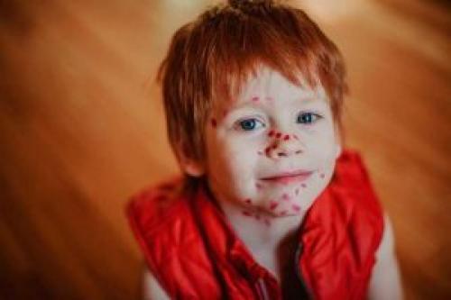 Как отмыть Фукорцин с белой одежды. Чем отмыть Фукорцин