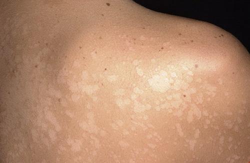 Как отмыть с лица йод. Как отмыть кожу лица и рук? 04