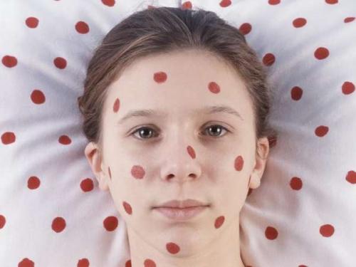 Обесцветить Фукорцин. Фукорцин: как убрать следы лекарства с разных поверхностей