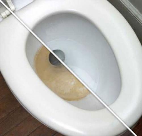 Как отмыть унитаз внутри где вода. Народные методы