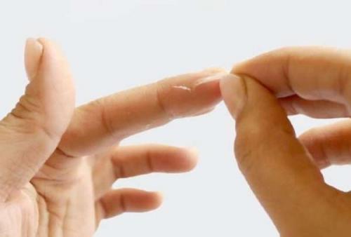 Чем убрать супер клей с кожи. Как убрать суперклей с кожи рук: эффективные методы и средства