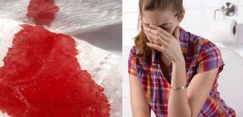 Как отстирать пятна вина. Чем и как отстирать красное вино: способы вывести пятно от вина 07