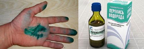 Как удалить зеленку с одежды в домашних условиях. Как отстирать зеленку с белой одежды 06