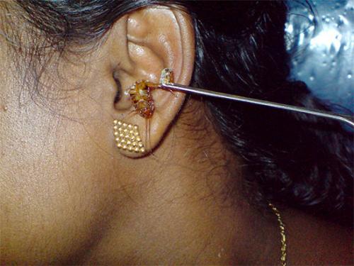 Всё о тараканах в доме и как с ними бороться. Чем вредны тараканы для человека