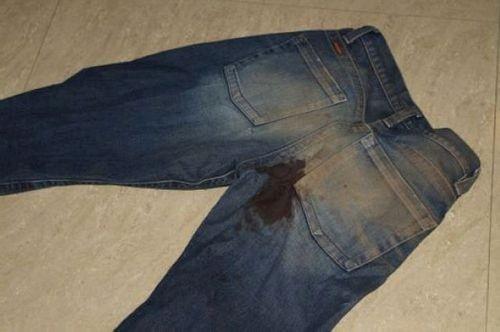 Как вывести пятно от растительного масла с джинс. Чем отстирать машинное масло с джинс