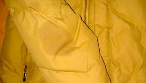 Как вывести жирное пятно с куртки. Как устранить старые пятна