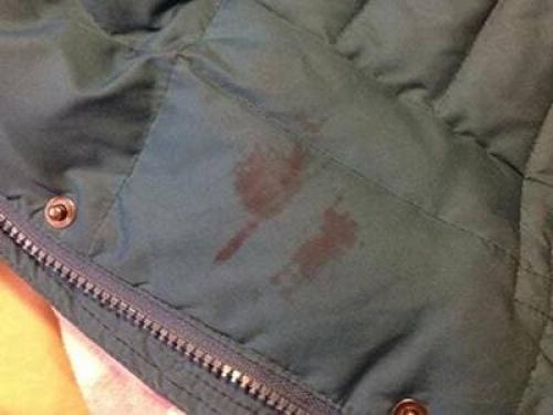 Можно ли использовать стиральные машины для удаления зелёных пятен. Что делать, если стиральная машина пачкает вещи или почему после стирки на одежде появляются пятна