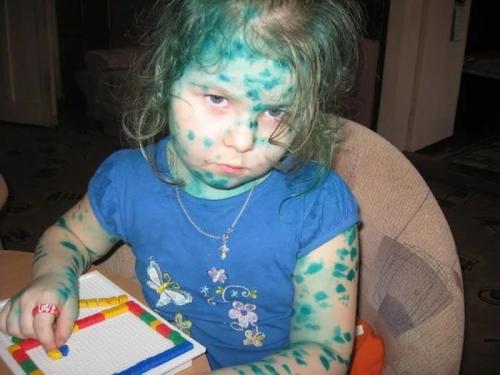 Как отличить качественную зеленку, которая не оставляет следов. Хочу все знать #206. История раствора бриллиантового зеленого, короче, обычной зеленки.