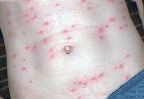 Чем вывести кошачьих блох из дома. Ша.  Узнайте, что собой представляют блохи 02