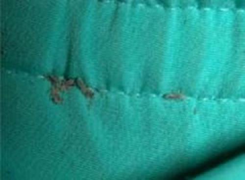 Бельевые вши, как обнаружить. Определение болезни. Причины заболевания 06 Бельевые вши, как обнаружить. Определение болезни. Причины заболевания 06