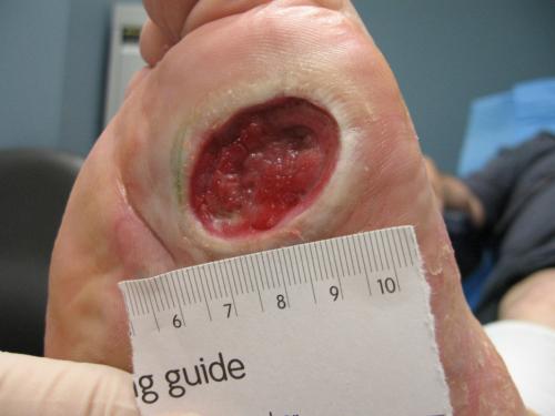 Как сделать новые тесные ботинки комфортными: советы и хитрости 01